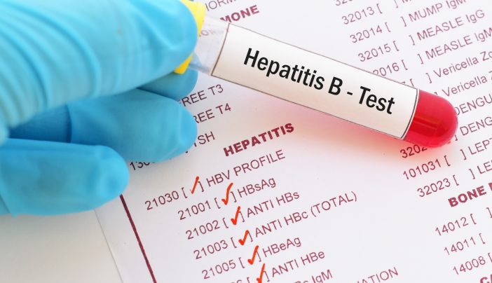 Hepatitis B and your cancer risk MD Anderson Cancer Center